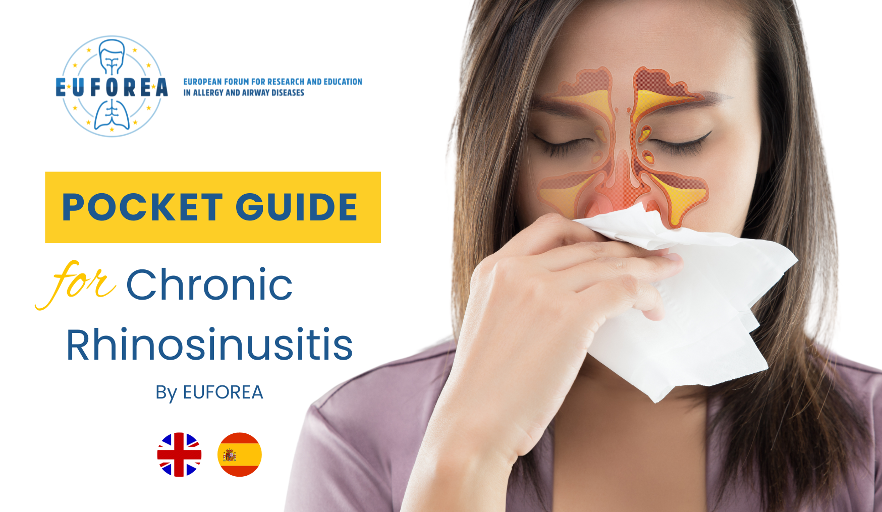 Chronic Rhinosinusitis Pocket Guide